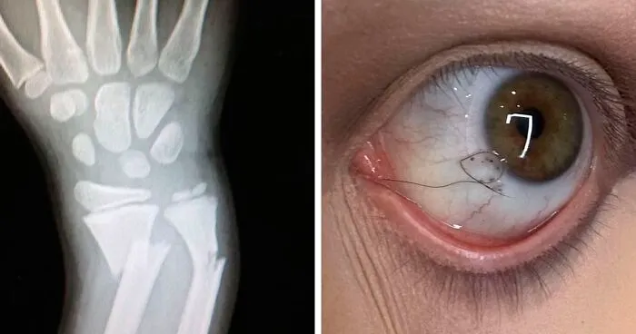 25 Inquietantes imágenes que nadie quiere ver, pero no puedes dejar de mirar